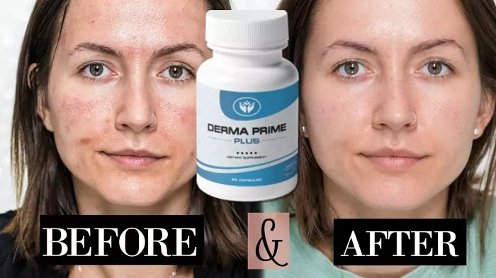 Know About Derma Prime Plus